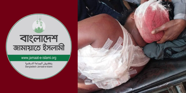 নাটোরে জামায়াত-বিএনপি সংঘর্ষে ইউনিয়ন জামায়াতের আমিরসহ ৭ জন আহত