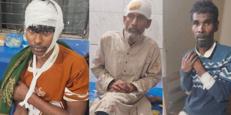 আ. লীগ নেতাদের হামলায় বিএনপির ৫ নেতাকর্মী আহত