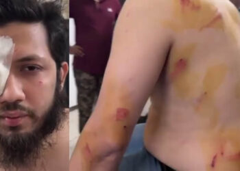 ইন্দিরা রোডে চাঁদাবাজিতে বাধা: এনসিপি নেতাদের ওপর ছাত্রদলের হামলা