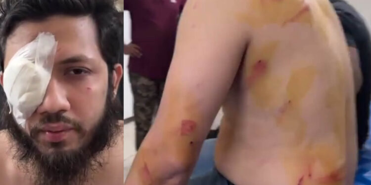 ইন্দিরা রোডে চাঁদাবাজিতে বাধা: এনসিপি নেতাদের ওপর ছাত্রদলের হামলা