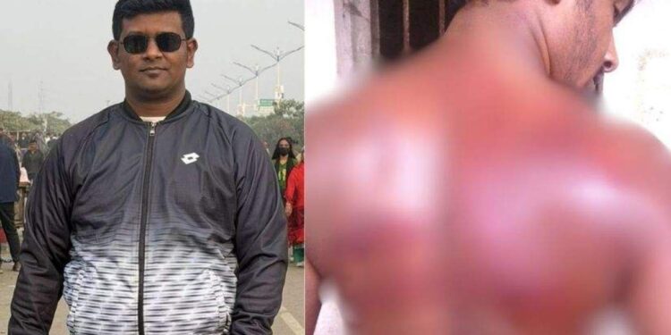 ১০ বছর আগে ঢাবির হল থেকে বের করে নির্যাতন ছাত্রলীগের, মামলার প্রস্তুতি ছাত্রদল নেতার