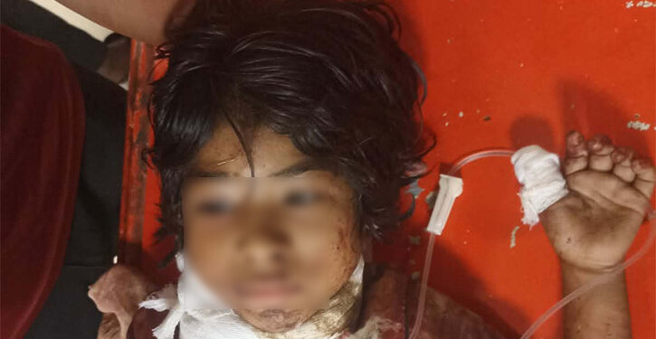 ইকোপার্কে উদ্ধার শিশুর মৃত্যু, হয়েছিল ধর্ষণের শিকার