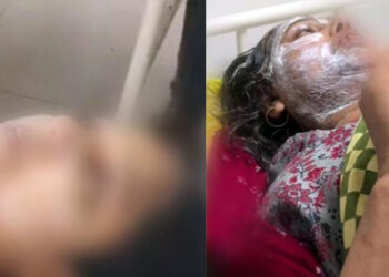 বিহারে অগ্রিম টাকা দিয়ে গয়না চাওয়ায় মুসলিম মা-মেয়ের মুখে অ্যাসিড নিক্ষেপ