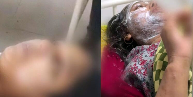 বিহারে অগ্রিম টাকা দিয়ে গয়না চাওয়ায় মুসলিম মা-মেয়ের মুখে অ্যাসিড নিক্ষেপ