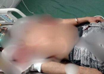 কেন্দ্রীয় শহীদ মিনারে গুলিবিদ্ধ কন্টেন্ট ক্রিয়েটর রাকিব মারা গেছেন