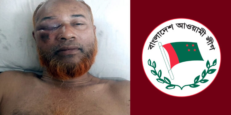 ঈদের দিন আ.লীগ নেতাকে পিটিয়ে মৃত ভেবে ফেলে যায় দুর্বৃত্তরা