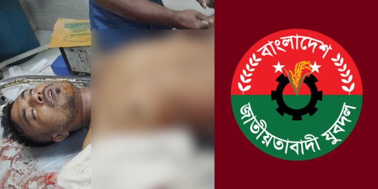 ব্যবসায়ীকে তুলে নিয়ে হাত-পা ভেঙে দিলেন যুবদল নেতা