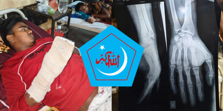 পাবনায় শিবিরের ওয়ার্ড সভাপতিকে আশঙ্কাজনক অবস্থায় হাসপাতালে