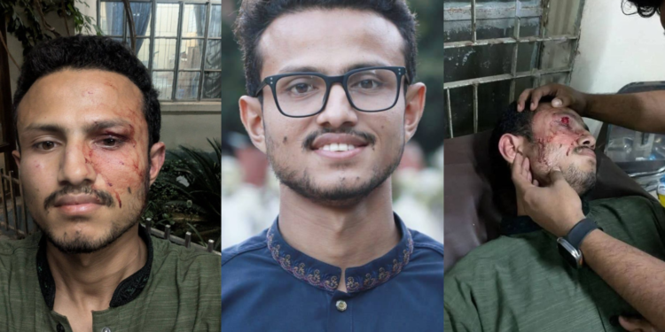 চাকসু নেতা মাসুম বিল্লাহর ওপর অতর্কিত হামলা, গলা কেটে হত্যার চেষ্টা