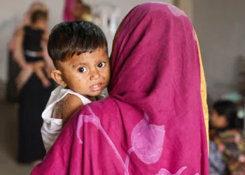 হাম ও উপসর্গে আরো ৭ শিশুর মৃত্যু