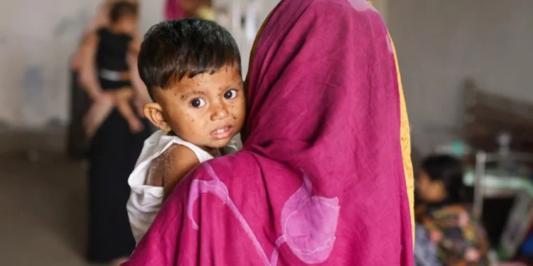 হাম ও উপসর্গে আরো ৭ শিশুর মৃত্যু