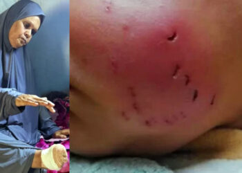 গাজার আশ্রয়শিবিরে ঘুমন্ত মুসলিমদের শরীর কামড়ে খাচ্ছে ইঁদুর