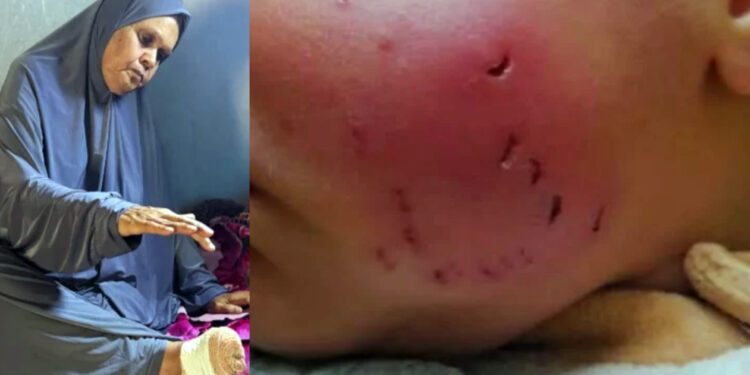 গাজার আশ্রয়শিবিরে ঘুমন্ত মুসলিমদের শরীর কামড়ে খাচ্ছে ইঁদুর