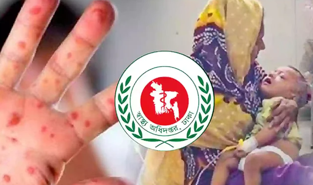 হামের উপসর্গ নিয়ে ২৪ ঘণ্টায় আরও ৪ শিশুর মৃত্যু