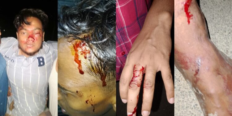 মাদক সেবনের প্রতিবাদ করায় এলাকাবাসীর ওপর হামলা, আহত ১০