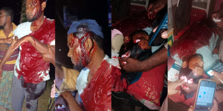 পাবনায় জামায়াত নেতার ওপর নিষিদ্ধ আওয়ামী লীগের সন্ত্রাসী হামলা