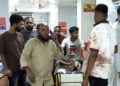 কোরবানি দিতে গিয়ে সারাদেশে অন্তত ৫৭৬ জন জখম