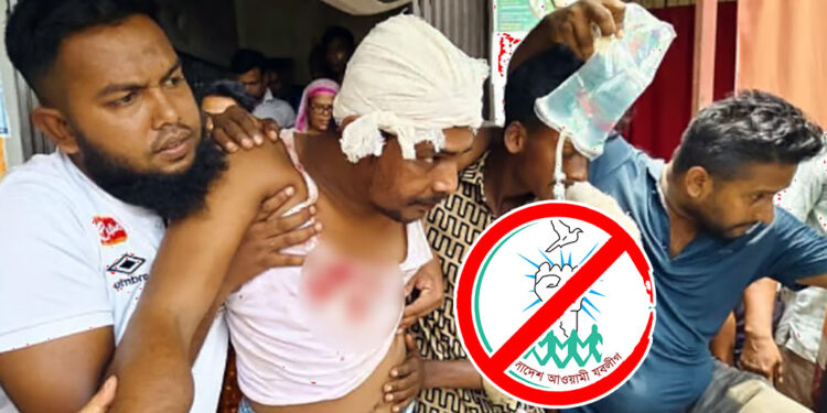 কুমারখালী পৌর ভবনে যুবলীগ নেতার ভাইকে এলোপাতাড়ি কুপিয়ে জখম
