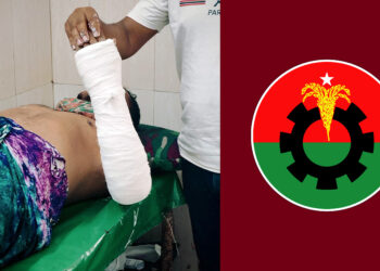 চাঁদা না পেয়ে ব্যবসায়ীর হাত-পা ভেঙে দিলেন শ্রমিক দল নেতা