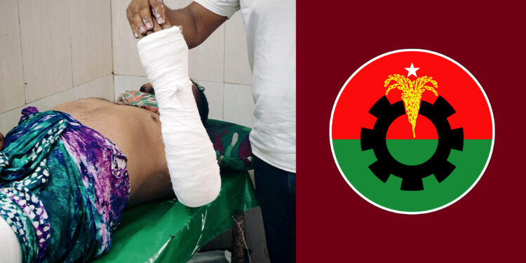 চাঁদা না পেয়ে ব্যবসায়ীর হাত-পা ভেঙে দিলেন শ্রমিক দল নেতা