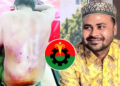 চাঁদা না পেয়ে ব্যবসায়ীকে গরম রড দিয়ে ছ্যাঁকা দিলেন শ্রমিক দল নেতা