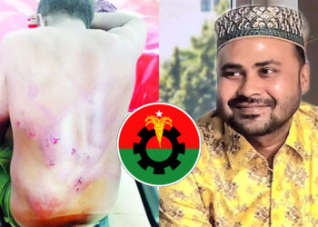 চাঁদা না পেয়ে ব্যবসায়ীকে গরম রড দিয়ে ছ্যাঁকা দিলেন শ্রমিক দল নেতা