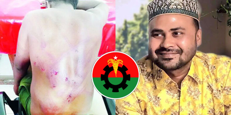 চাঁদা না পেয়ে ব্যবসায়ীকে গরম রড দিয়ে ছ্যাঁকা দিলেন শ্রমিক দল নেতা