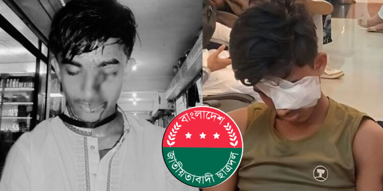 এক চোখ হারাতেই হলো ছাত্রদলের হামলায় আহত সেই আলিফকে