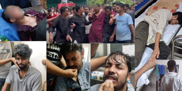 জবিতে ছাত্রদলের দফায় দফায় হামলায় জকসুর ভিপি-জিএস, সাংবাদিক, শিক্ষকসহ আহত ২০